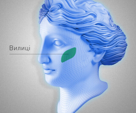 Ботулінотерапія вилиць у м Рівне