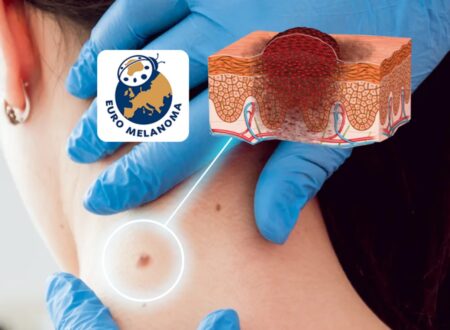 Підсумки проведеної перевірки новоутворень до Всесвітнього дня меланоми