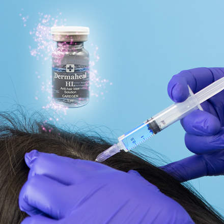 Мезотерапія волосся Dermaheal HL у м Рівне