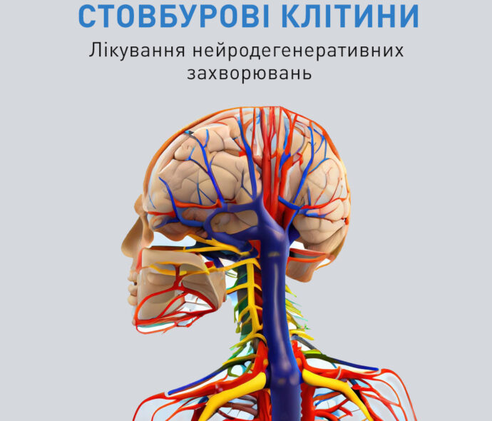 Лікування нейродегенеративних захворювань стовбуровими клітинами у м Рівне