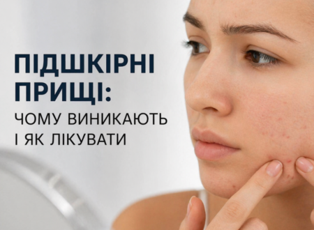 Підшкірні прищі: причини виникнення та ефективне лікування у Рівному | Alpha Cell